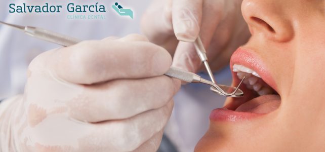 Dientes supernumerarios: ¿Tienes algún diente de más?