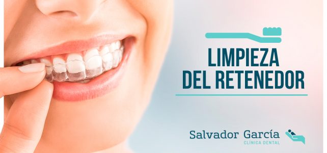 Retenedor dental: función, tipos y mantenimiento