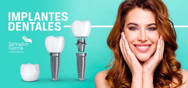 Implantes Dentales: Proceso e Importancia  de este tratamiento