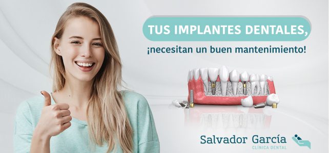 Mantenimiento de los implantes dentales, ¿qué hacer tras la cirugía dental?