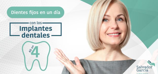 Implantes dentales “All on Four”: Dientes fijos en un día