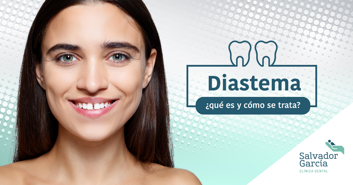 diastema dental