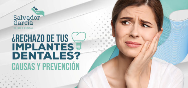 Rechazo de implantes dentales: síntomas de alerta