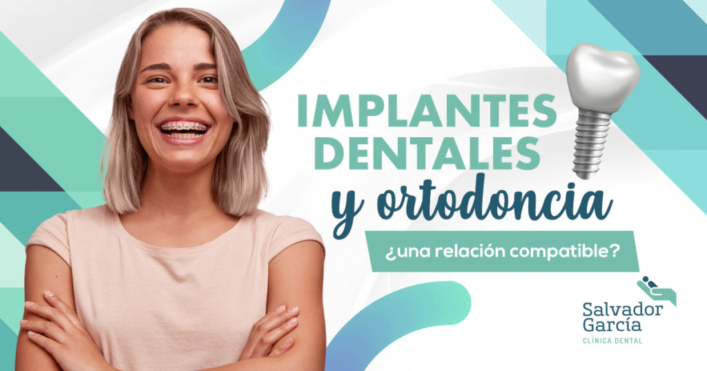 implantes dentales y ortodoncia 