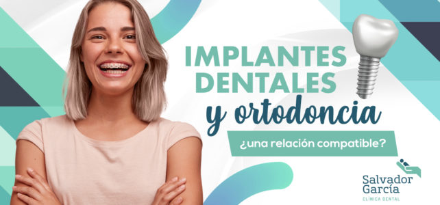 Implantes dentales, cuándo colocarlos en un tratamiento de ortodoncia