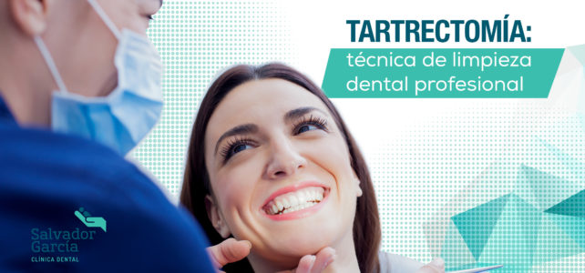 Tartrectomía: elimina la placa bacteriana y cuida tu salud bucodental