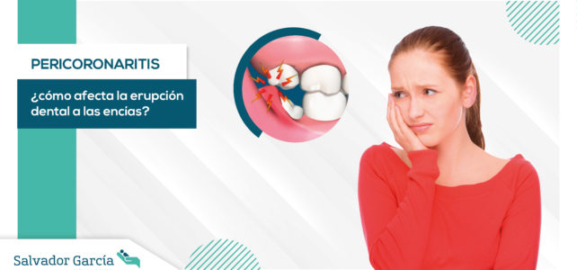 Pericoronaritis: ¿cómo afecta la erupción dental a las encías?