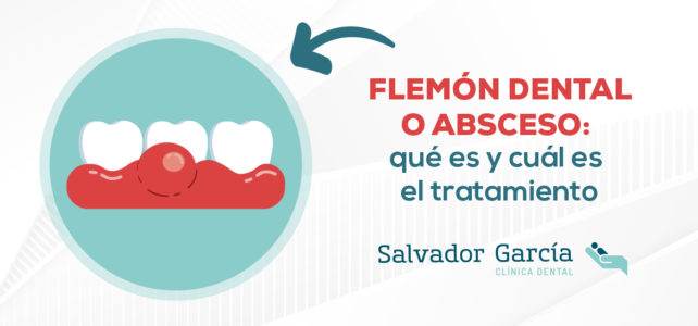 Flemón dental o absceso: qué es y cuál es el tratamiento