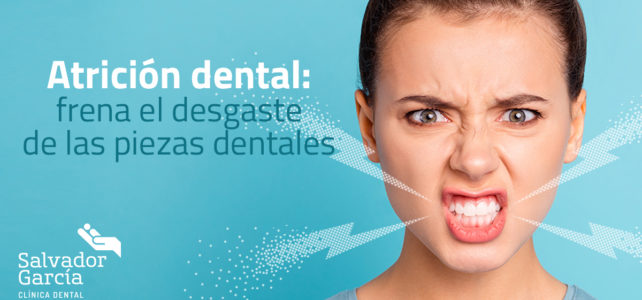 Atrición dental: frena el desgaste de las piezas dentales