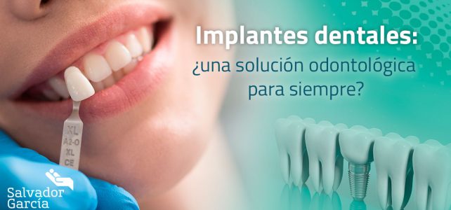 Implantes dentales: ¿una solución odontológica para siempre?