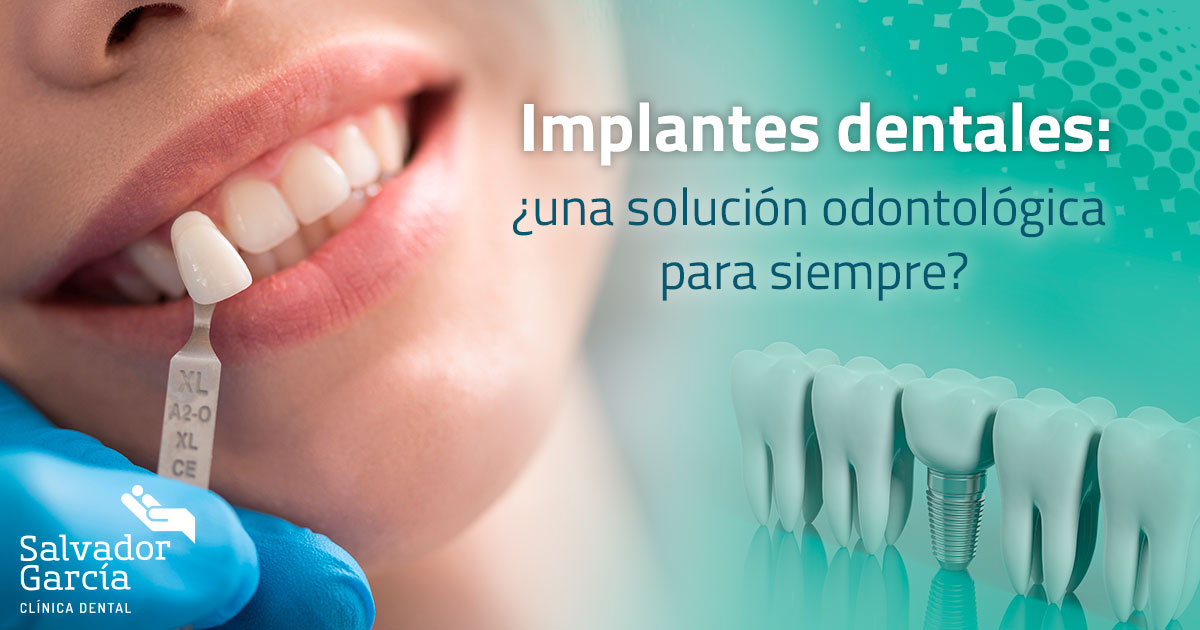Ordinario Condición previa Separar Implantes dentales: ¿una solución odontológica para siempre?