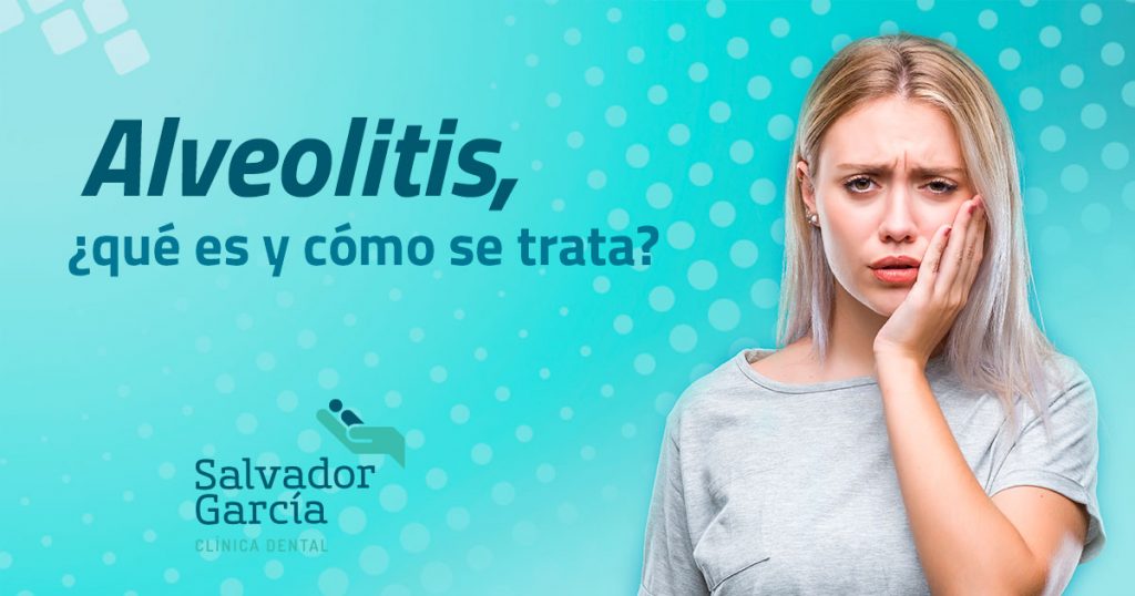 Alveolitis ¿qué Es Y Cómo Se Trata 