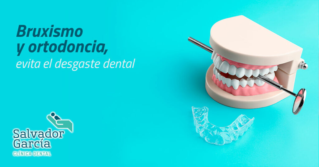 Férula de descarga para tratara el Bruxismo - Clínica Area Dental