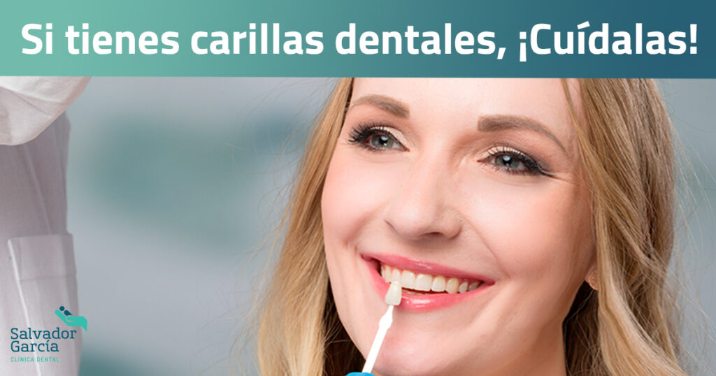 Diferencias implantes y carillas, Blog