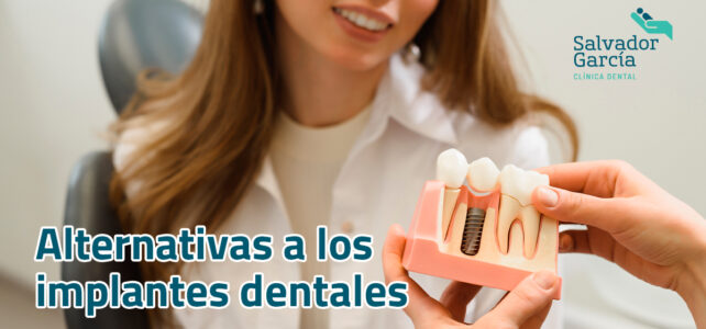 Alternativas al implante dental para colocar los dientes
