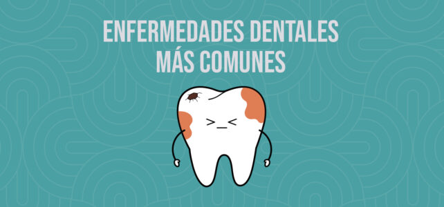 ¿Conoces las enfermedades dentales más frecuentes?