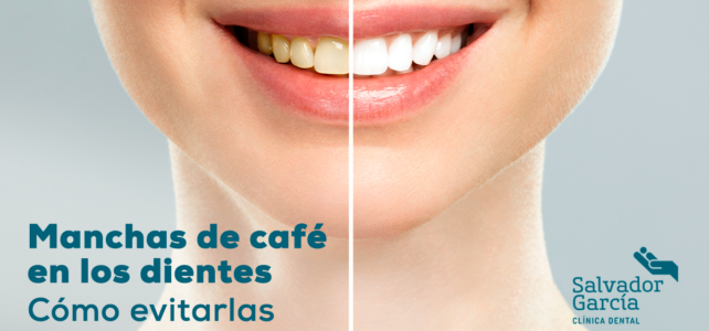 Manchas de café en los dientes: cómo evitarlas