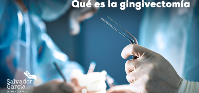 Qué es la gingivectomía y cuando se realiza