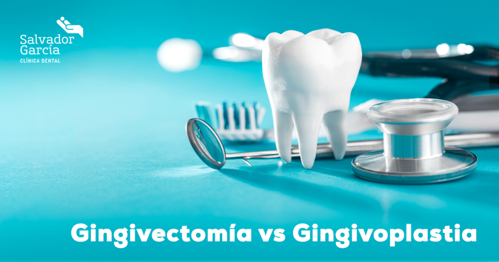 Gingivectomía vs Gingivoplastia