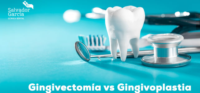 ¿Cuál es la diferencia entre gingivectomía y gingivoplastia?