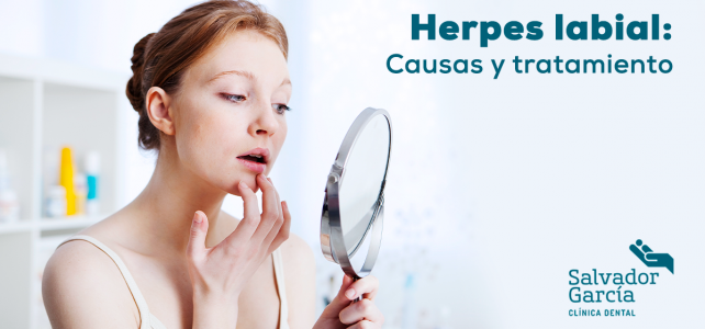 Herpes labial: causas y tratamiento