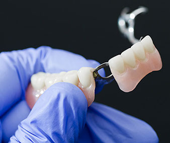 protesis dentales precios
