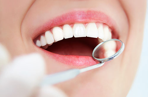 ortodoncia estetica