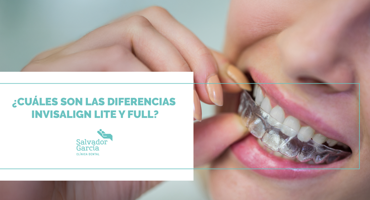 ¿Cuáles son las Diferencias Invisalign Lite y Full?
